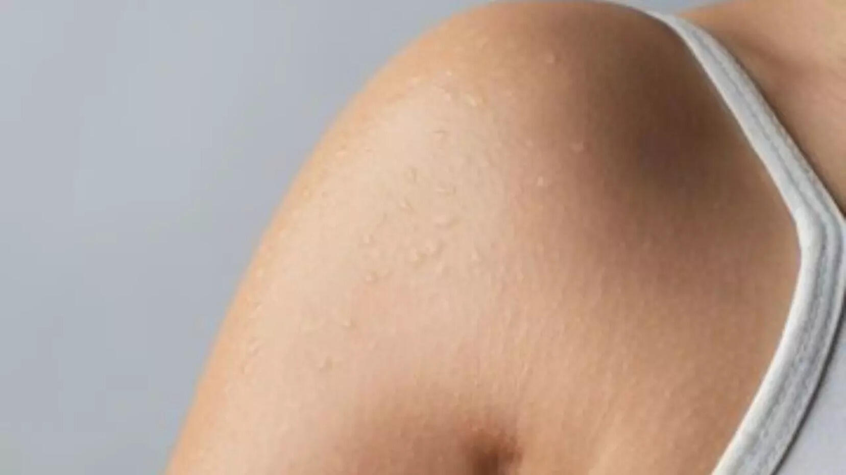 6 Best Soaps For Dry Skin Female