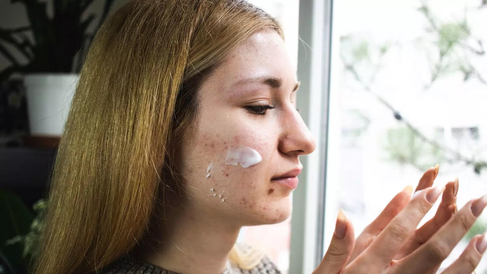 10 Best Sunscreens for Acne-Prone Skin in 2024