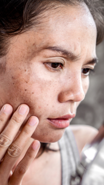 How To Use Castor Oil To Remove Skin Pigmentation